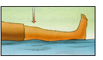 A post operative patient lying on a flat surface doing Quad Set exercizes