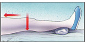 A post operative knee replacement patient lying on a flat surface doing Knee Straightening exercises